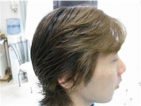 中村くん施術前横顔.JPG