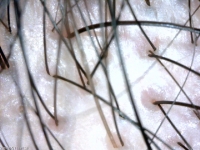 長田さん頭皮 (2).jpg